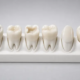 When a Full-Tooth Cap Isn’t the Only Path Guide to Restorative Choices